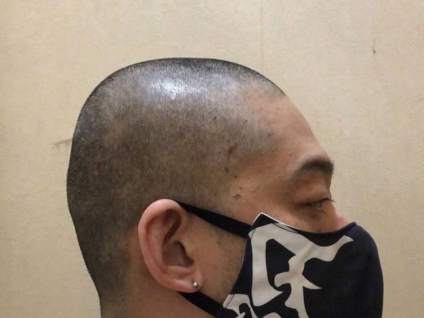 「髪の毛が入ってる」　クレームを受け、丸刈りにし謝罪に行くと思いもよらぬ結末が…