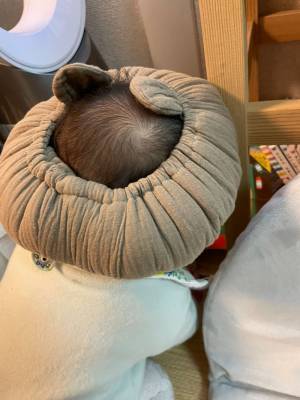 「嫌がらずかぶってくれているけれど…」　親が気になる、その『見た目』