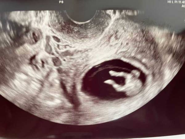 赤ちゃんの写真に、診察室にいた全員が爆笑！　その理由がコチラです