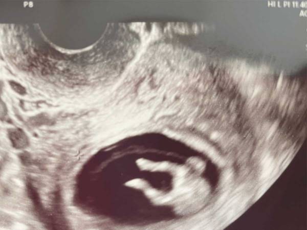 赤ちゃんの写真に、診察室にいた全員が爆笑！　その理由がコチラです