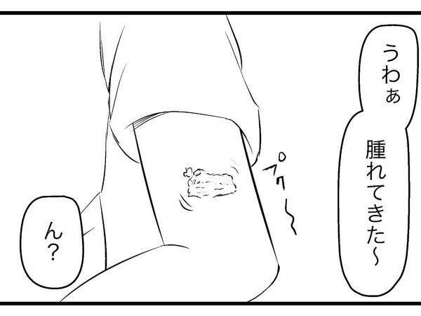 蚊に、一切刺されなくなった男性　理由に「複雑な気持ち」「嬉しいけどムカつく」