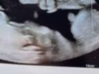病院で超音波検査を受けた妊婦　撮影されたエコー写真に「ありえない！」