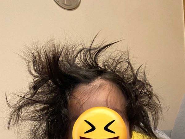 「笑いが止まらない」「実験失敗したのか！？」　１歳の娘、髪型がとんでもないことに
