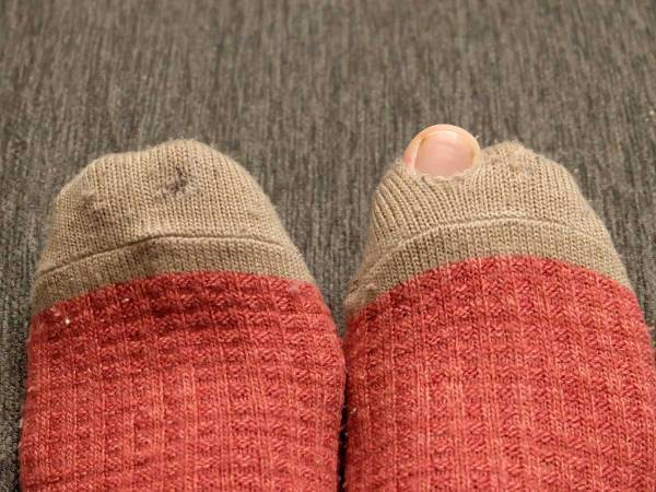 『靴下の穴』をなんていう？　宮城県民のいい方がお茶目すぎる　「かわいい」「真似しよ」