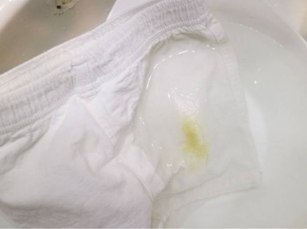 服についたカレーのシミを落とす方法に「それ使うのか」　特別な道具を使わずに…？