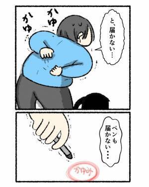 背中が「かゆすぎる！」　必死になった女性がとった奇行に「笑った」「分かる」