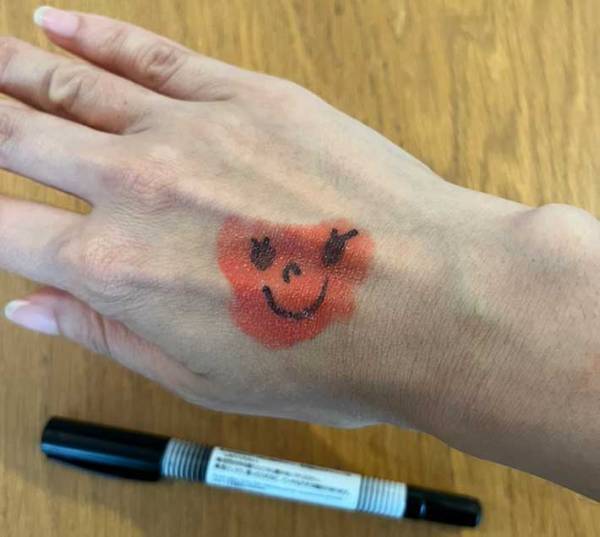 肌に付いた油性ペン　秒で落とす方法とは？　「すごく簡単」「意外だった」