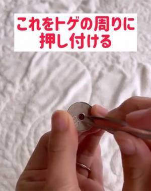 指に刺さった『小さなトゲ』にイラッ　あるアイテムを使うと？　「コレはいい方法」