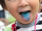 舌についたかき氷シロップの色が「全然落ちない…」　歯科医に聞いてみると？