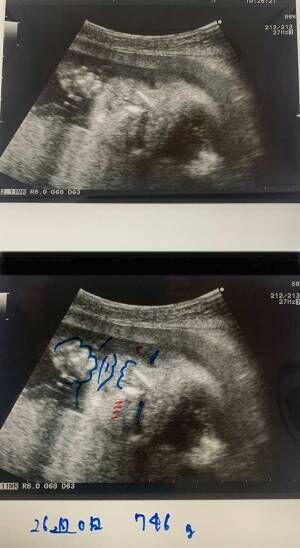 同じエコー写真を２枚渡す産婦人科医　その理由に「素敵な心遣い」「これは嬉しい」