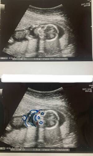 同じエコー写真を２枚渡す産婦人科医　その理由に「素敵な心遣い」「これは嬉しい」