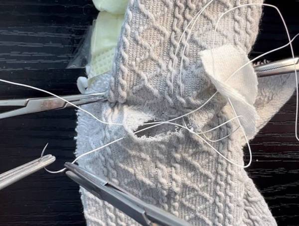 お気に入りのズボンが破けて泣く娘　父親の全力に「縫い方が手術のそれ」「吹き出した」