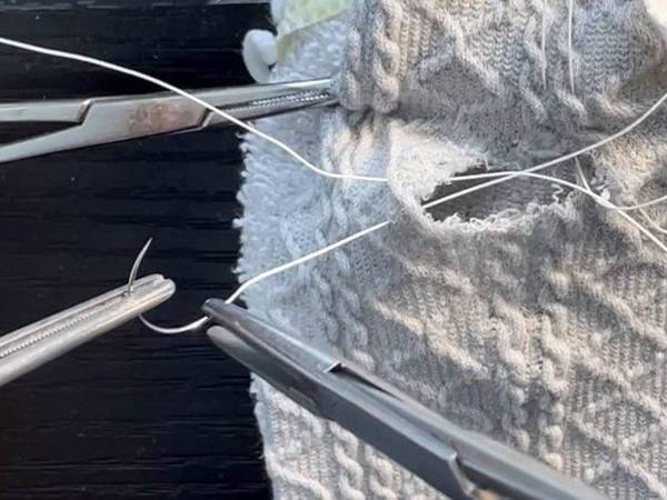 お気に入りのズボンが破けて泣く娘　父親の全力に「縫い方が手術のそれ」「吹き出した」