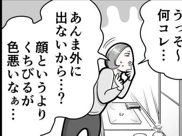 ある日突然、唇が紫色になった女性　「何かの病気？」と不安になっていると…