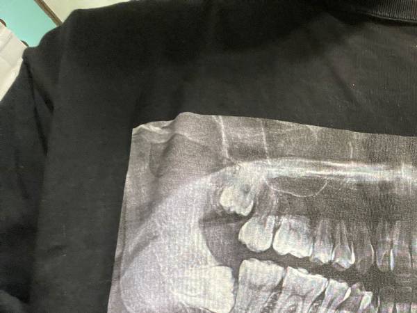 薬剤師が爆笑した、患者のTシャツ　まさかのセンスに「意味が分からない」「ジワジワくる」