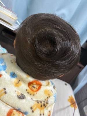 赤ちゃんの後頭部に「笑った」「可愛すぎるだろ」　つむじが２年後には…？