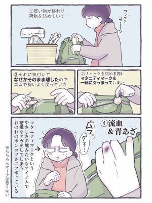 マタニティマークでケガをした…　妊婦の体験談に「他人事とは思えない」