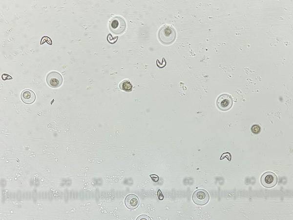 顕微鏡をのぞいた男性　普段見かけない『アイツ』を見つけて…？