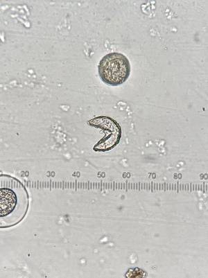 顕微鏡をのぞいた男性　普段見かけない『アイツ』を見つけて…？