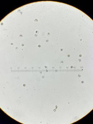 顕微鏡をのぞいた男性　普段見かけない『アイツ』を見つけて…？