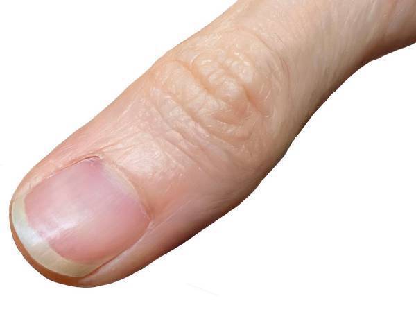 『指』の画像に「ちょっと待って」　正体に「絶句した」「すごすぎて意味が分からん」