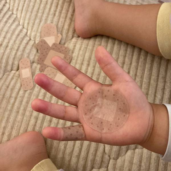 絆創膏の代わりにコレ！　子供達にウケた物に「全親が救われそう」「需要ありすぎる」
