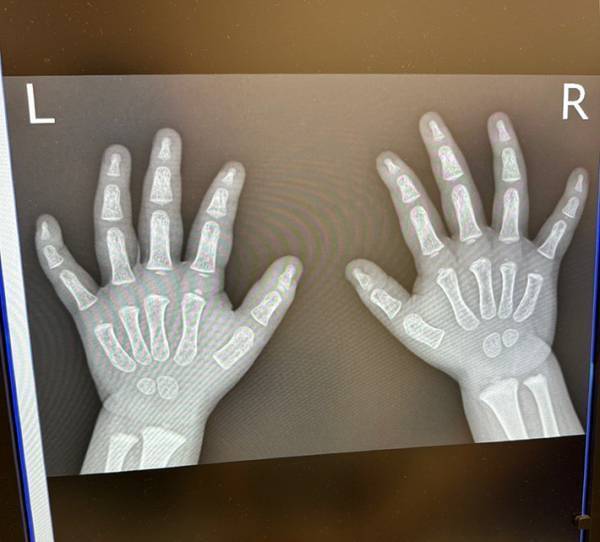 医師が笑った『レントゲン画像』　写っていたモノに「尊い」「たまらん…」