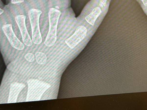 医師が笑った『レントゲン画像』　写っていたモノに「尊い」「たまらん…」