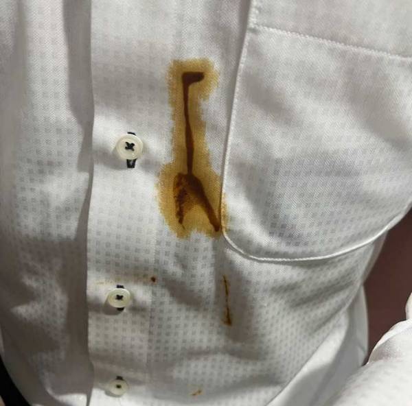 男性「なんで味噌カツなんて食べたんだ」　後悔した理由に「ごめん笑った」