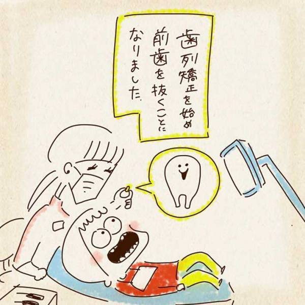 ２歳息子を育てる母親　ある日、歯医者で前歯を取り除いたら…？