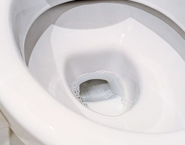 黄ばみを予防するなら？　トイレをいつでも清潔に保つ方法に「これならできそう」