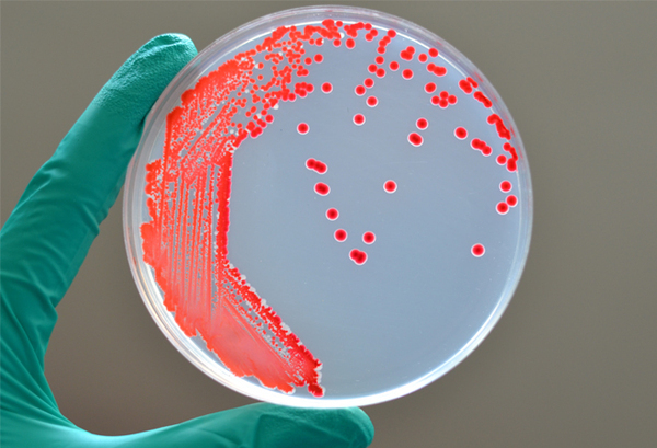 卵の異変に要注意！　殻をむいたら「え？」　白身がピンク色なワケ