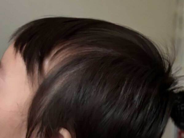 赤ちゃんの後頭部を見つめるポメ　何をしているのかというと…？