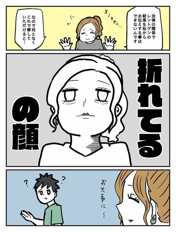 「これはできる放射線技師さん」　患者に症状を伝えた方法が？「なるほど」「面白い」