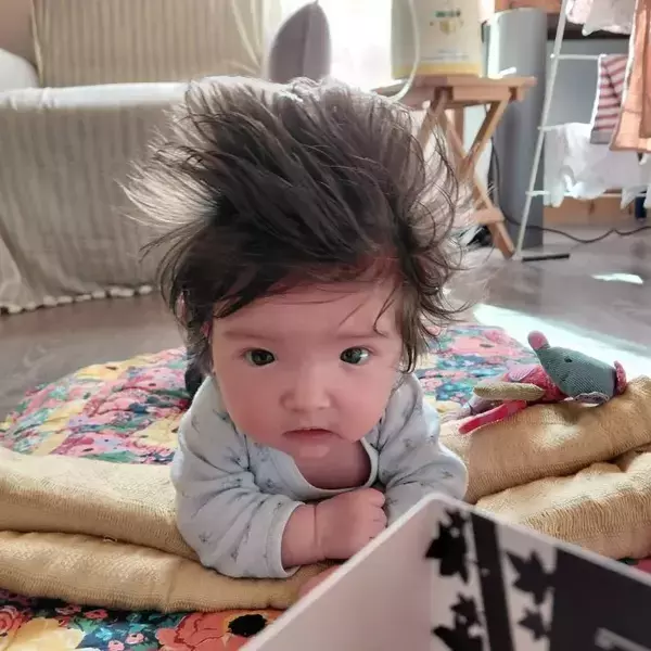 「こんな子、見たことない！」　生まれた瞬間、誰もが驚いた赤ちゃんの『姿』とは？