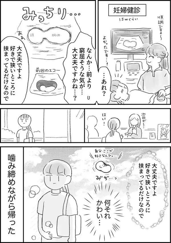 妊婦「何それ、可愛い…」　エコー検査で見えた赤ちゃんの姿とは？