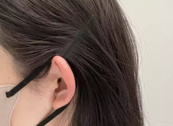 マスクをヘアピンで留めると…　マスクの不快感を軽減する2種類の方法を試してみると？