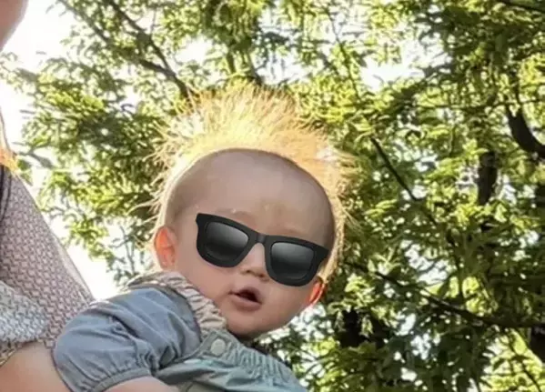 1歳児の頭に起きた奇跡…　写真に「選ばれし赤ちゃん」「爆笑した」