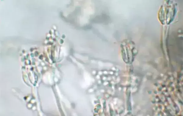 【検証】3年間未清掃のスマホを検査！　カバーの内側を顕微鏡で見てみたら…？