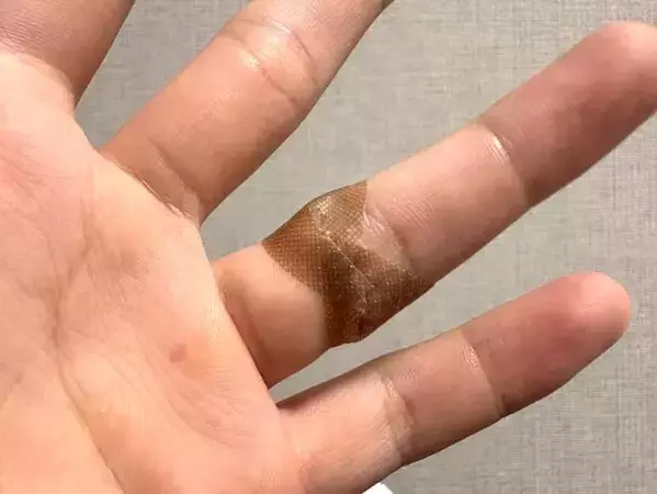 指先に絆創膏を貼るには？　覚えておきたい『剥がれにくくなる』アイディア