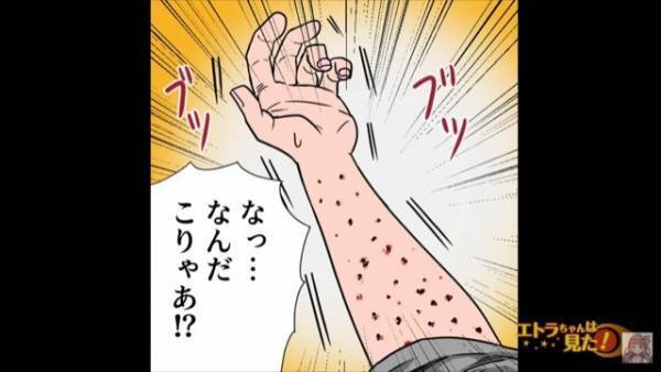 日に日に増える“蕁麻疹”に違和感。病院に行くと…⇒医者『原因が分かりました！』20年間放置された【診断結果】にゾッ！？【漫画】
