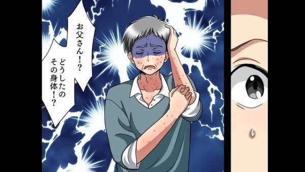 父の身体に”謎の蕁麻疹”が…娘『どうしたの、その身体！？』父『苦しい…』⇒父を苦しめた【意外な原因】にゾッ…