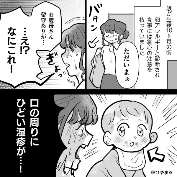 生後10ヶ月”卵アレルギー”の娘に…「卵舐めさせた」義母のせいで発疹が！？直後⇒ブチ切れた嫁の【宣告】に顔面蒼白！？