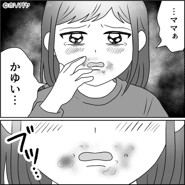 アレルギーの娘の食物に、牛乳を混入させた義母。しかし⇒嫁が血相を変え“明かした事実”に、義母「そんな…」