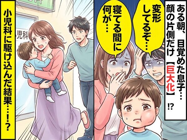 ある朝目覚めた息子…顔の片側だけ【巨大化】！？夫「変形してるぞ…」妻「寝てる間に何が…」⇒小児科に駆け込んだ結果！？