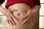 妊娠線とは何？原因と「妊娠線をつくらない」3つの予防方法をご紹介