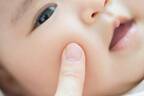 赤ちゃんの肌はどうして乾燥しやすいの？　原因と対策を解説