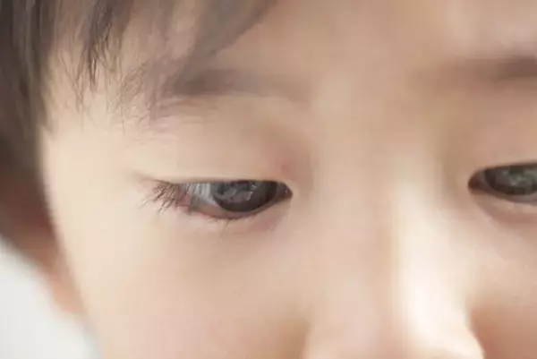 眼振（がんしん）とは？種類や原因、症状から治療方法まで詳しく解説します！