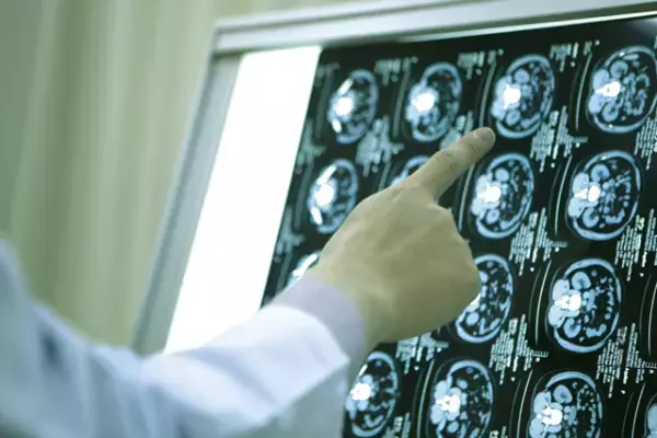 相貌失認とは？症状、原因、相談・診断・受診先から、発達障害との関わりについて解説します