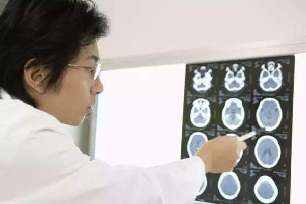 高次脳機能障害とは？症状・診断基準・治療法・相談先・周囲の対応法まとめ